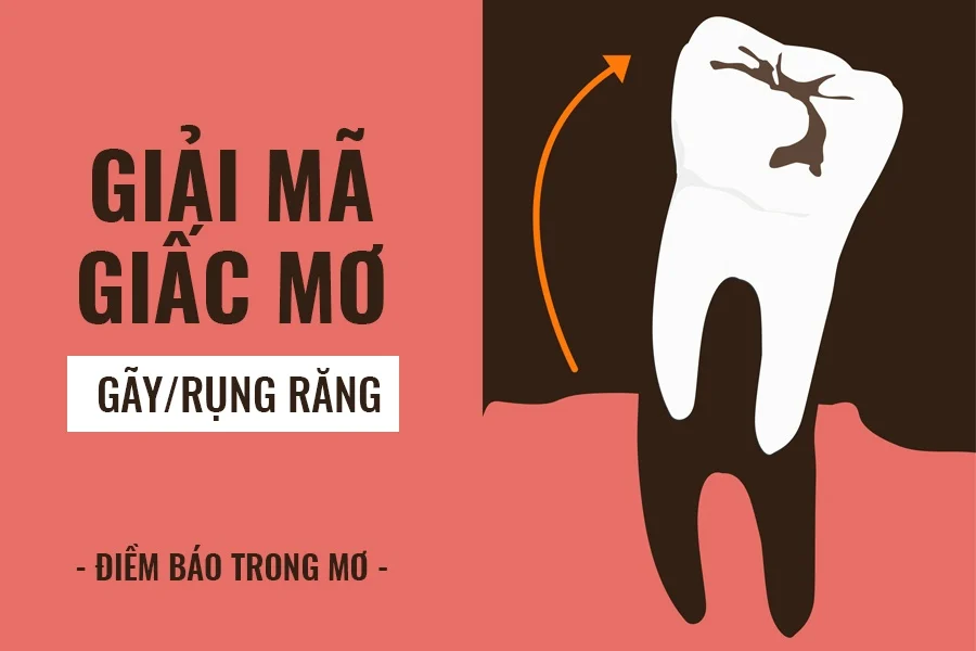 Các con số may mắn liên quan đến giấc mơ thấy gãy răng