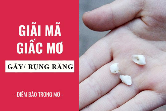 Giải mã giấc mơ thấy gãy răng